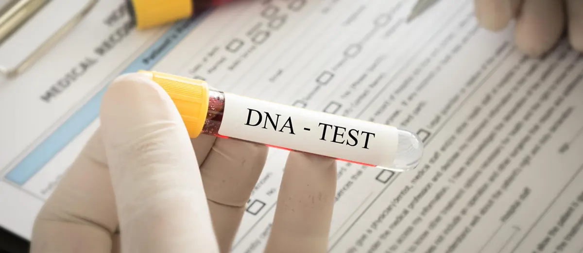 Amostra de sangue para teste de DNA em recipiente de laboratório.