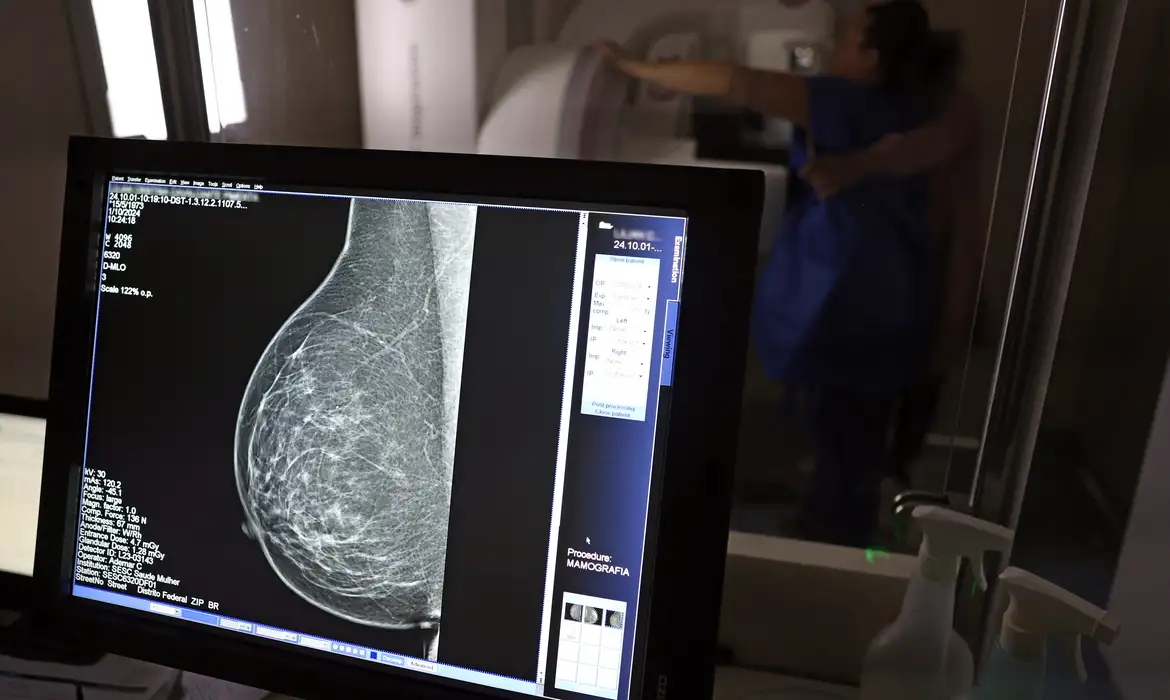Imagem de tela de computador exibindo mamografia digital em ambiente hospitalar.